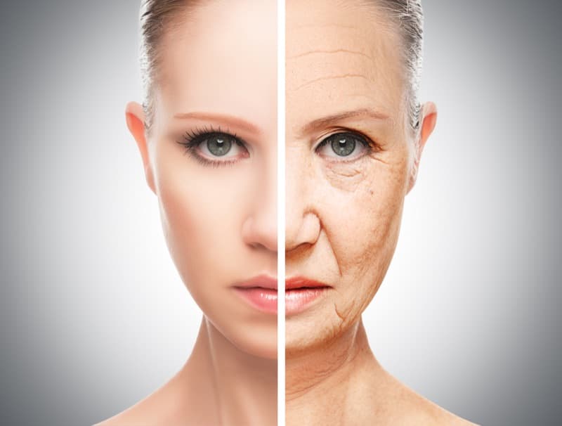 Before and after skin tightening around the eyes